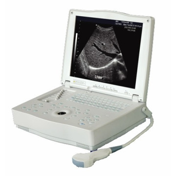 Scanner à ultrasons professionnel pour ordinateur portable médical (THR-LT001)